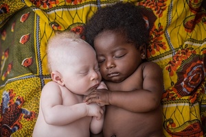 UNICEF Photo of the Year Award - najlepsze projekty fotograficzne 2013 roku 