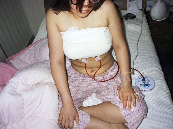 Ju Yeo fotograf fotografie Beauty Recovery Room kontrowersyjny projekt Korea Południowa chirurgia plastyczna obsesje piękno