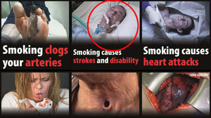Czy w kampanii antynikotynowej wykorzystano bez zgody zdjęcie umierającego niepalącego mężczyzny?