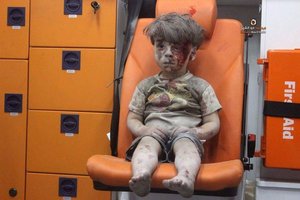 Chłopiec po bombardowaniu syryjskiego miasta Aleppo - fotografia, o której mówi cały świat