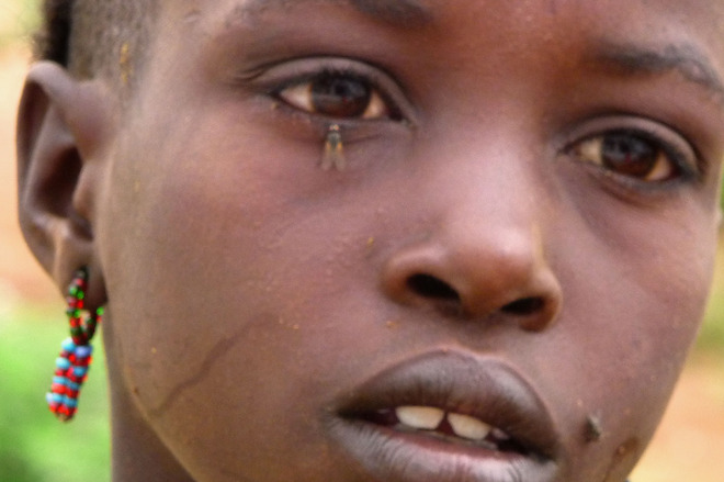 Etiopska łza